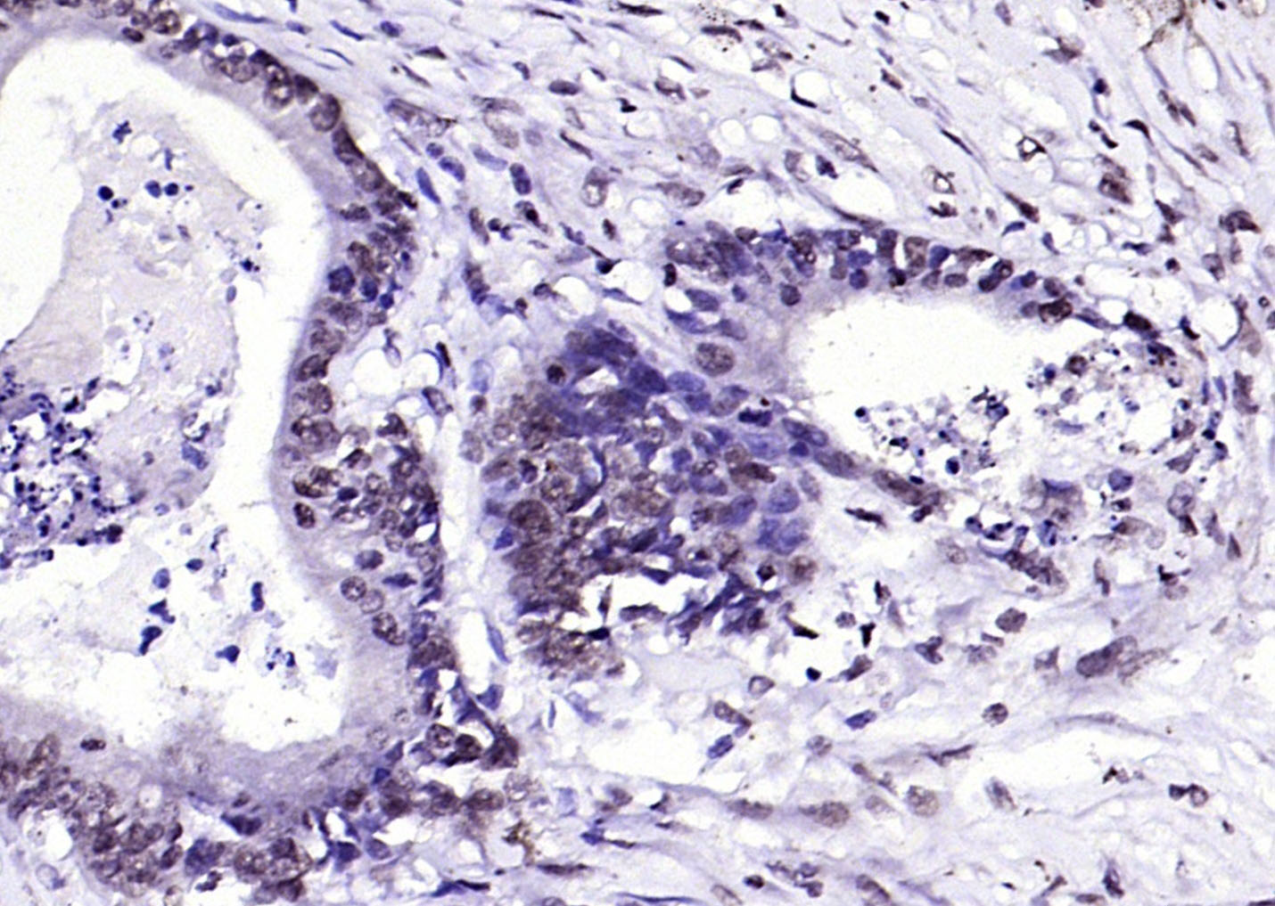 phospho-FGFR1 (Tyr307) Rabbit 