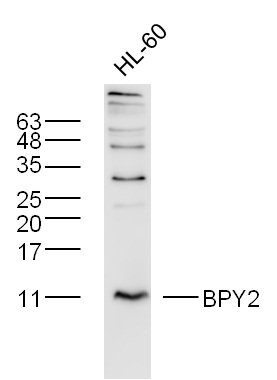 BPY2 Rabbit pAb(bs-12882R)-50u