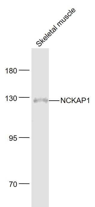 NCKAP1 Rabbit pAb(bs-6204R)-50