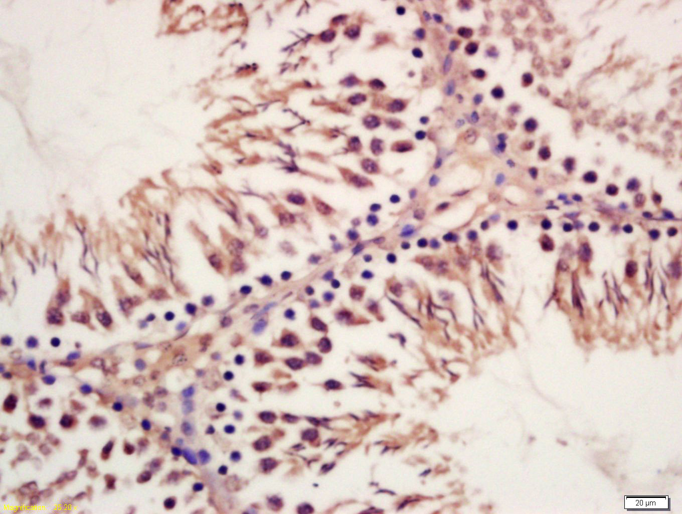 ORP1 Rabbit pAb(bs-17514R)-50u