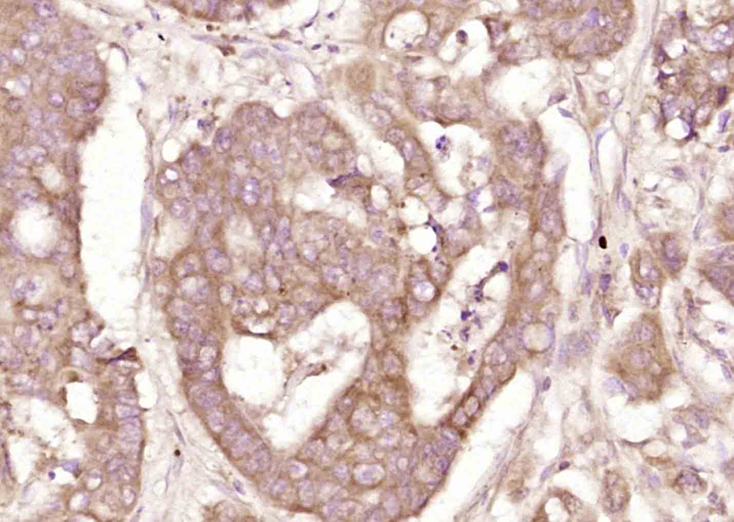 phospho-DDX58 (Thr170) Rabbit 