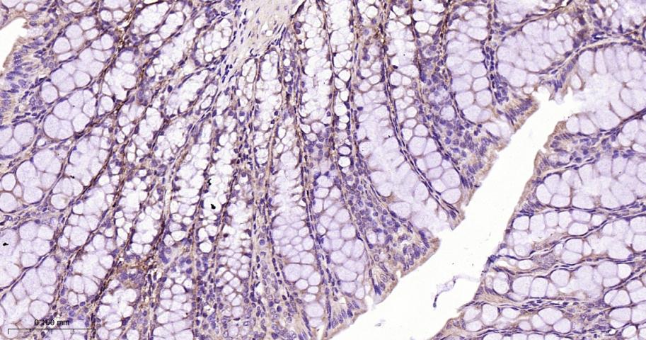 CPT1A Rabbit pAb(bs-2047R)-50u