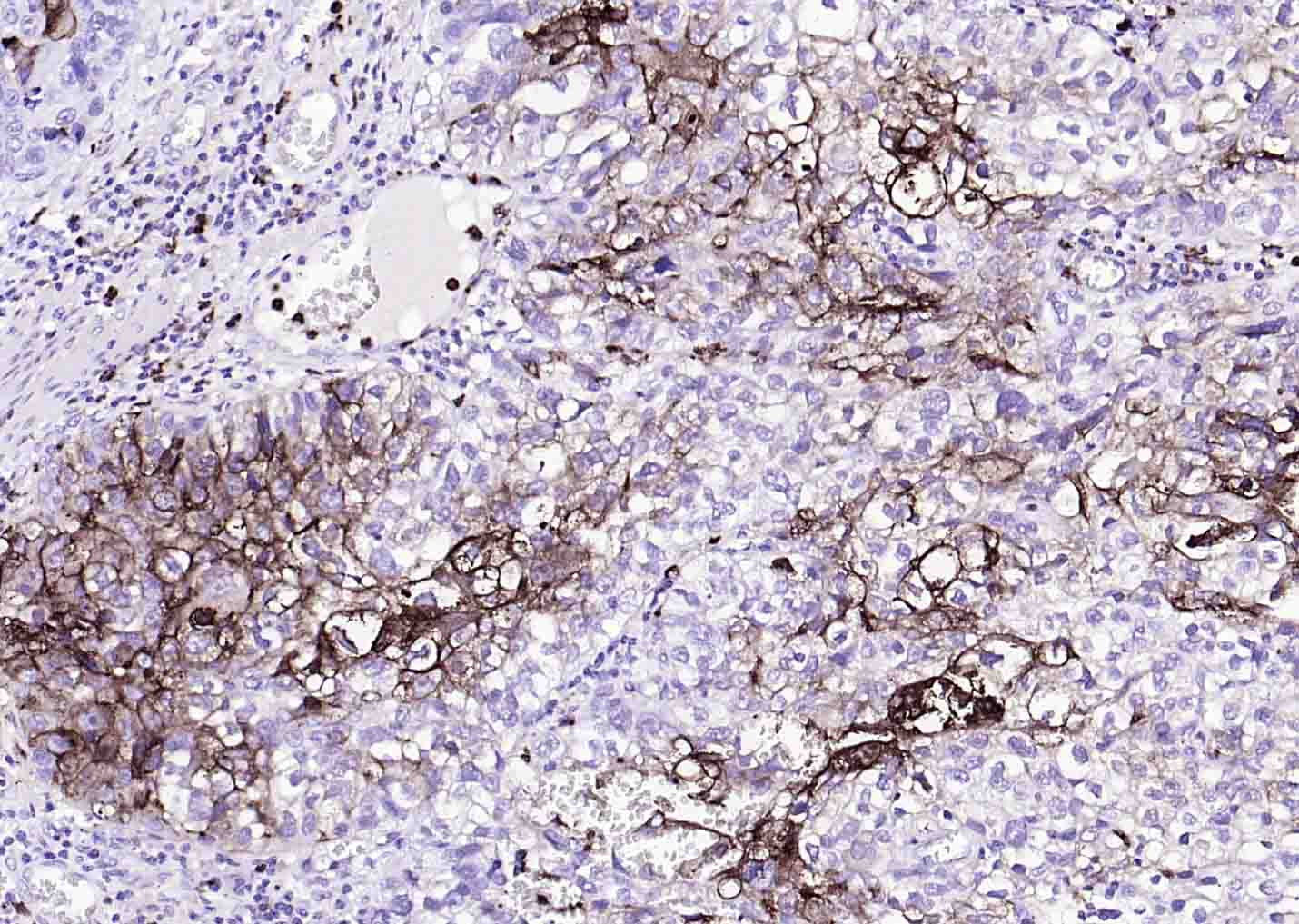 CEACAM5 Mouse mAb(bsm-43141M)-