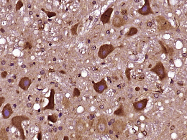 INT11/CPSF3L Rabbit pAb(bs-166