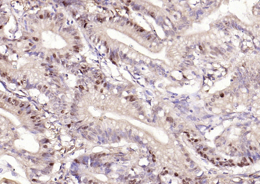 phospho-Beta catenin (Ser33 + 