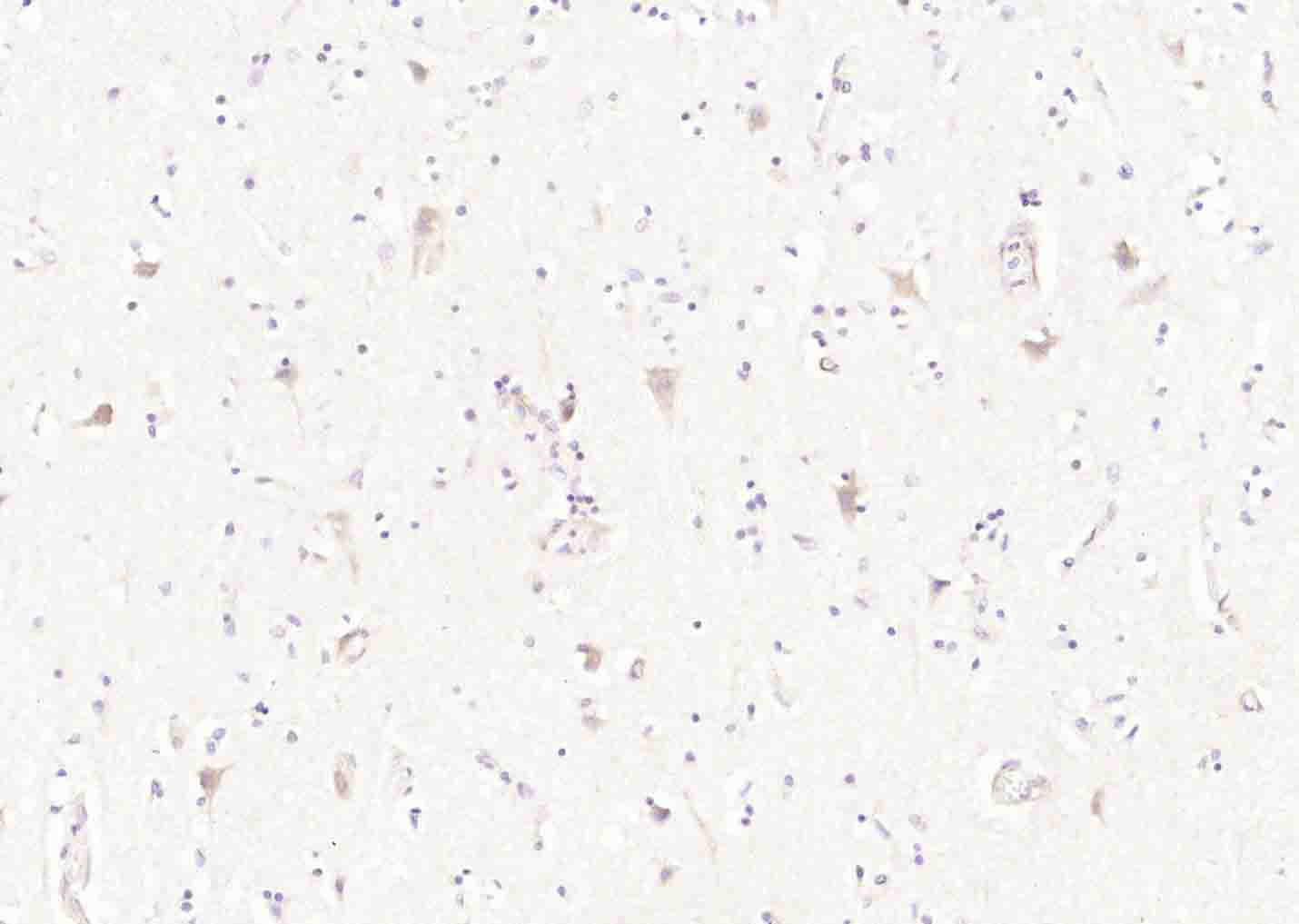 TMEM106B Rabbit pAb(bs-25543R)