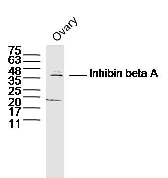 Inhibin beta A Rabbit pAb(bs-1