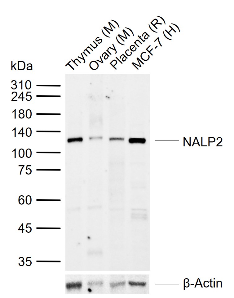 NALP2 Rabbit pAb(bs-6717R)-50u