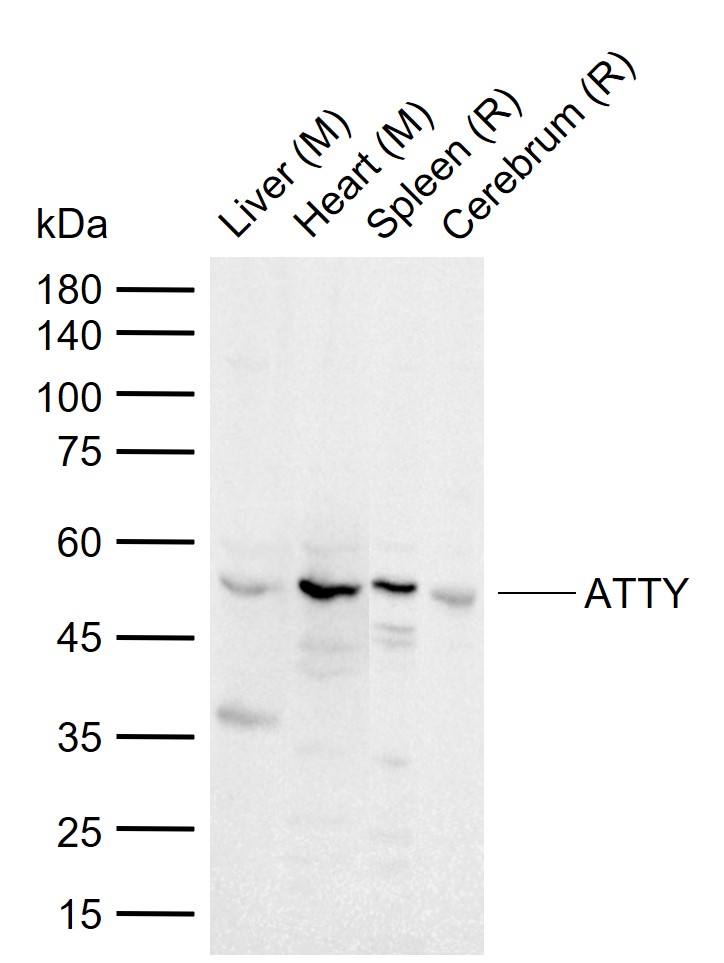 ATTY Rabbit pAb(bs-1907R)-50ul