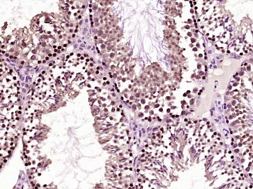 GTF3C4 Rabbit pAb(bs-16360R)-5