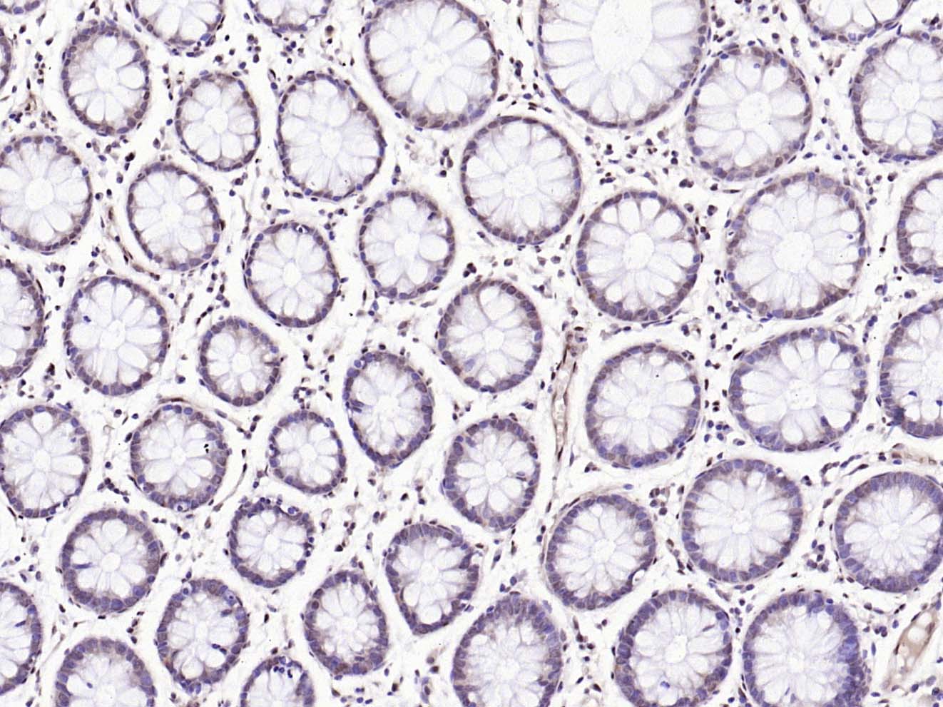 phospho-BRAF (Thr401) Rabbit p