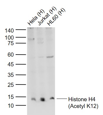 Histone H4 (Acetyl K12) Rabbit