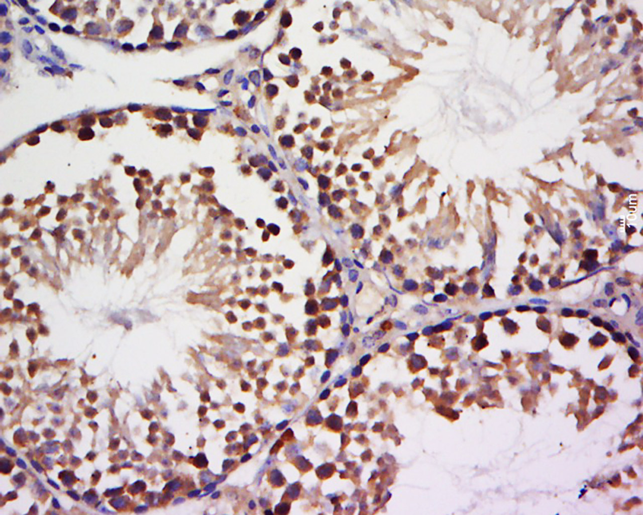 NEK9 Rabbit pAb(bs-9317R)-50ul