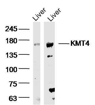 KMT4 Rabbit pAb(bs-16797R)-50u