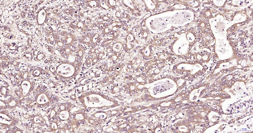 TBK1 Rabbit pAb(bs-7497R)-50ul