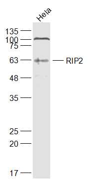 RIP2 Rabbit pAb(bs-3546R)-50ul