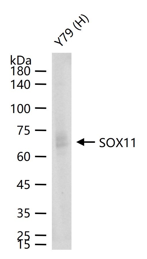 SOX11 Recombinant Rabbit mAb(b