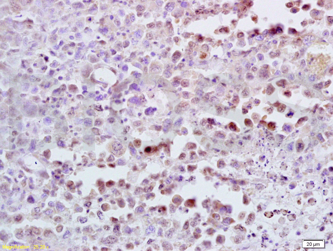 CDK4 Rabbit pAb(bs-0633R)-50ul