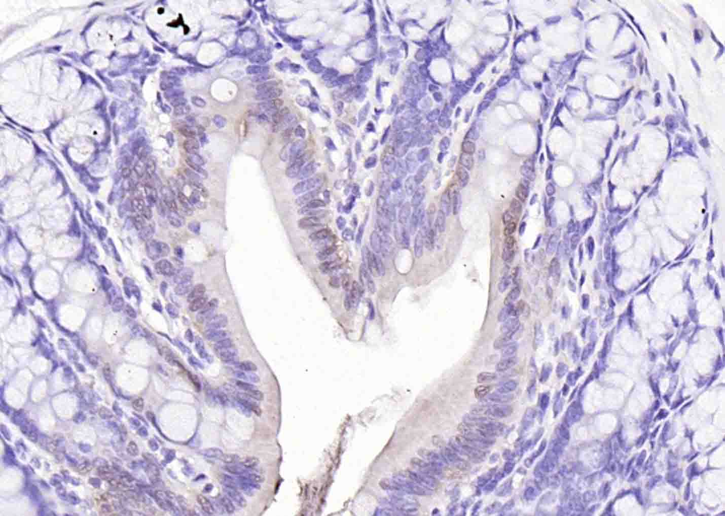 FAF1 Rabbit pAb(bs-1348R)-50ul