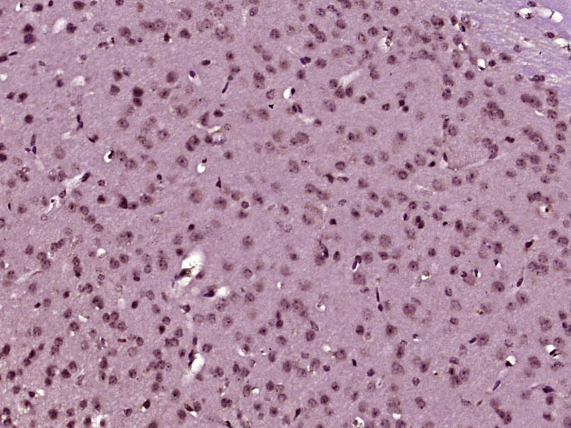 ERG/KCNH2 Rabbit pAb(bs-23703R