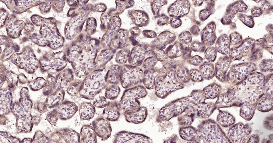 MMP12 Rabbit pAb(bs-1854R)-50u