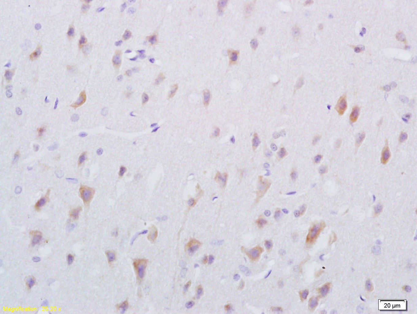 Oligophrenin 1 Rabbit pAb(bs-1