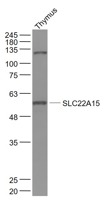 SLC22A15 Rabbit pAb(bs-21208R)