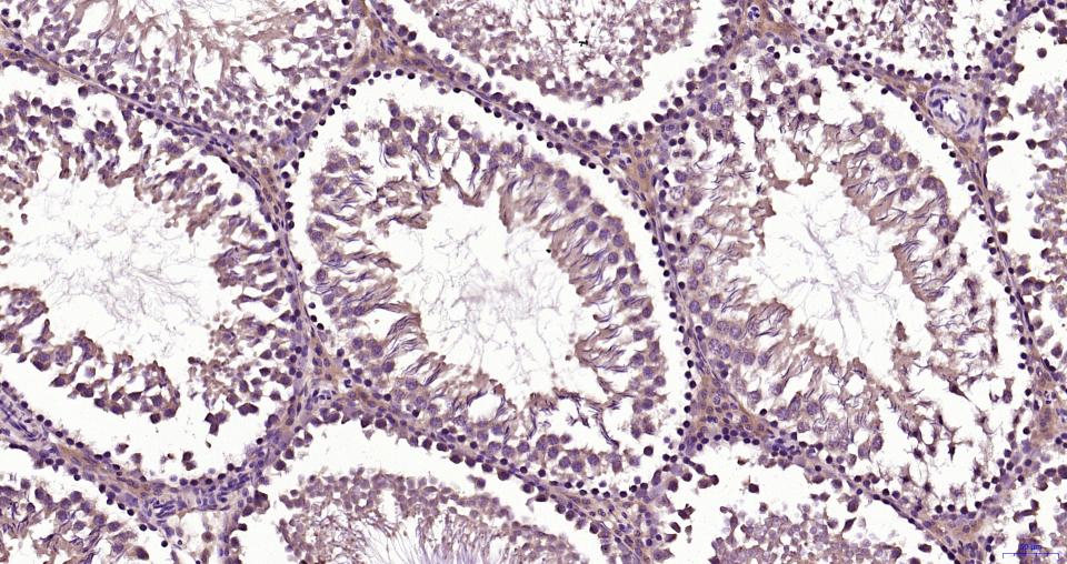 TBK1 Rabbit pAb(bs-7497R)-50ul