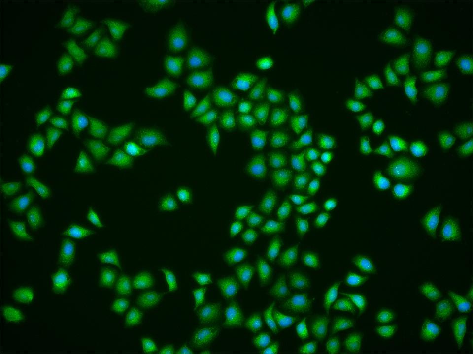 CIP2A/p90 Autoantigen Rabbit p