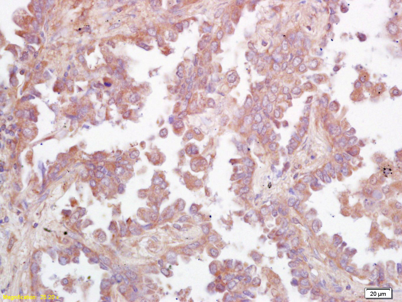 Ceramide glucosyltransferase R