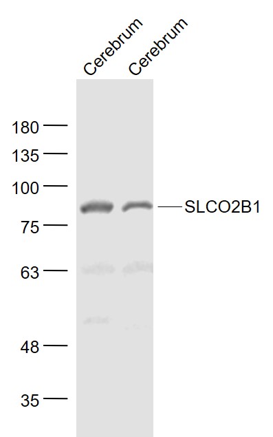 SLCO2B1 Rabbit pAb(bs-3913R)-5