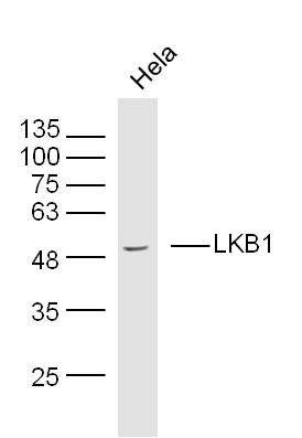 LKB1 Rabbit pAb(bs-3948R)-50ul
