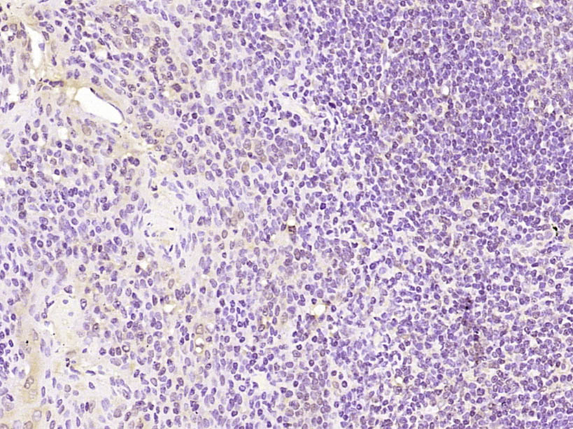 phospho-TOP2A (Ser1106) Rabbit