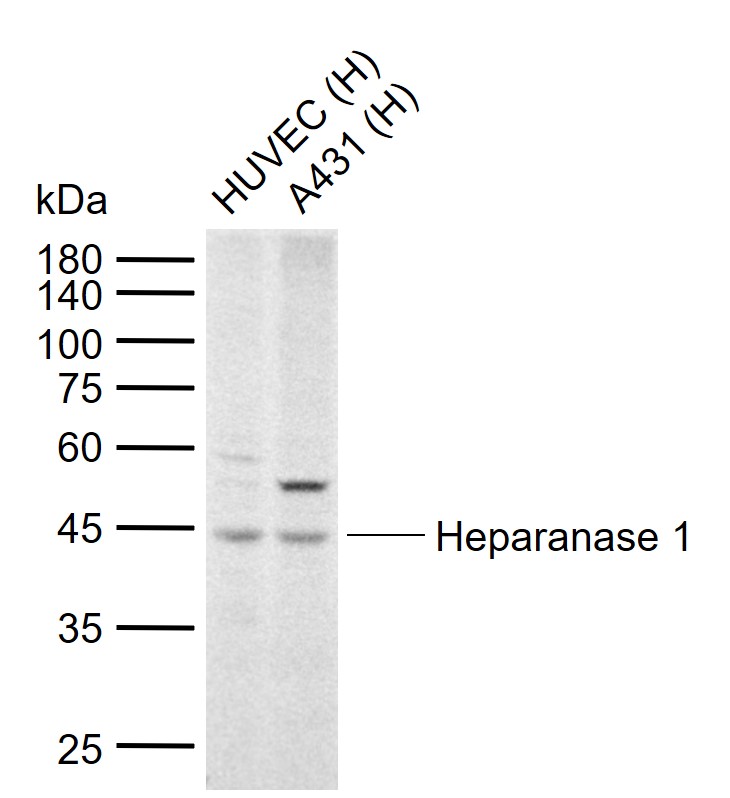 Heparanase 1 Rabbit pAb(bs-257