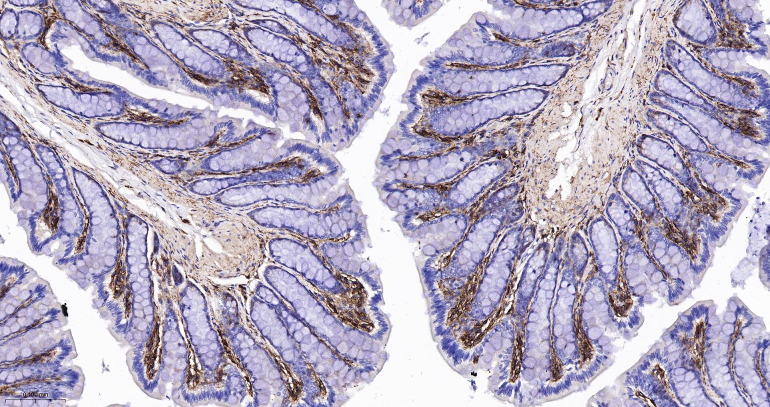 CD44 Recombinant Rabbit mAb(bs