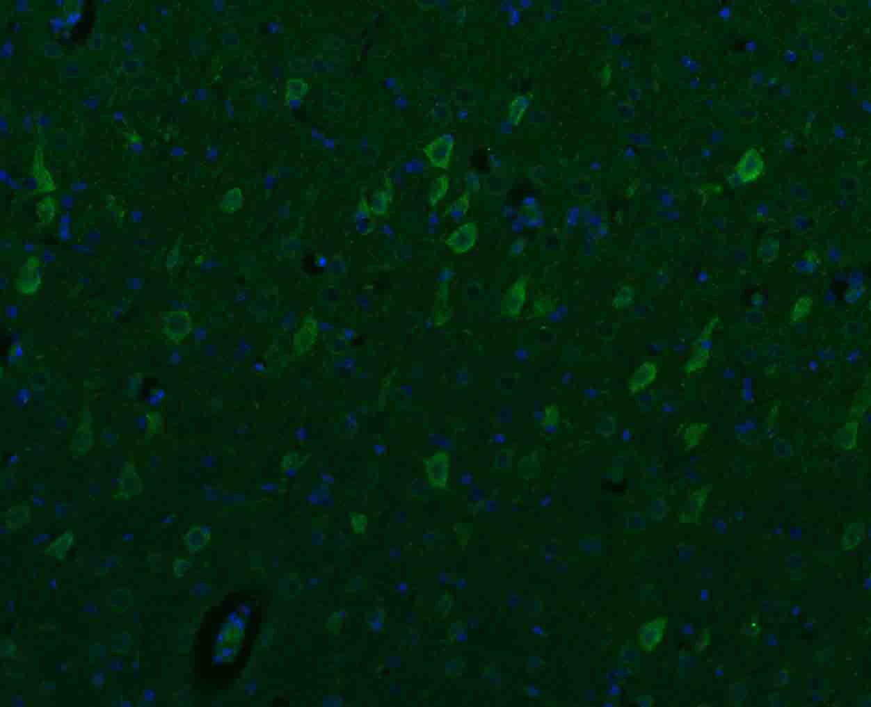 SGCB Rabbit pAb(bs-1127R)-50ul