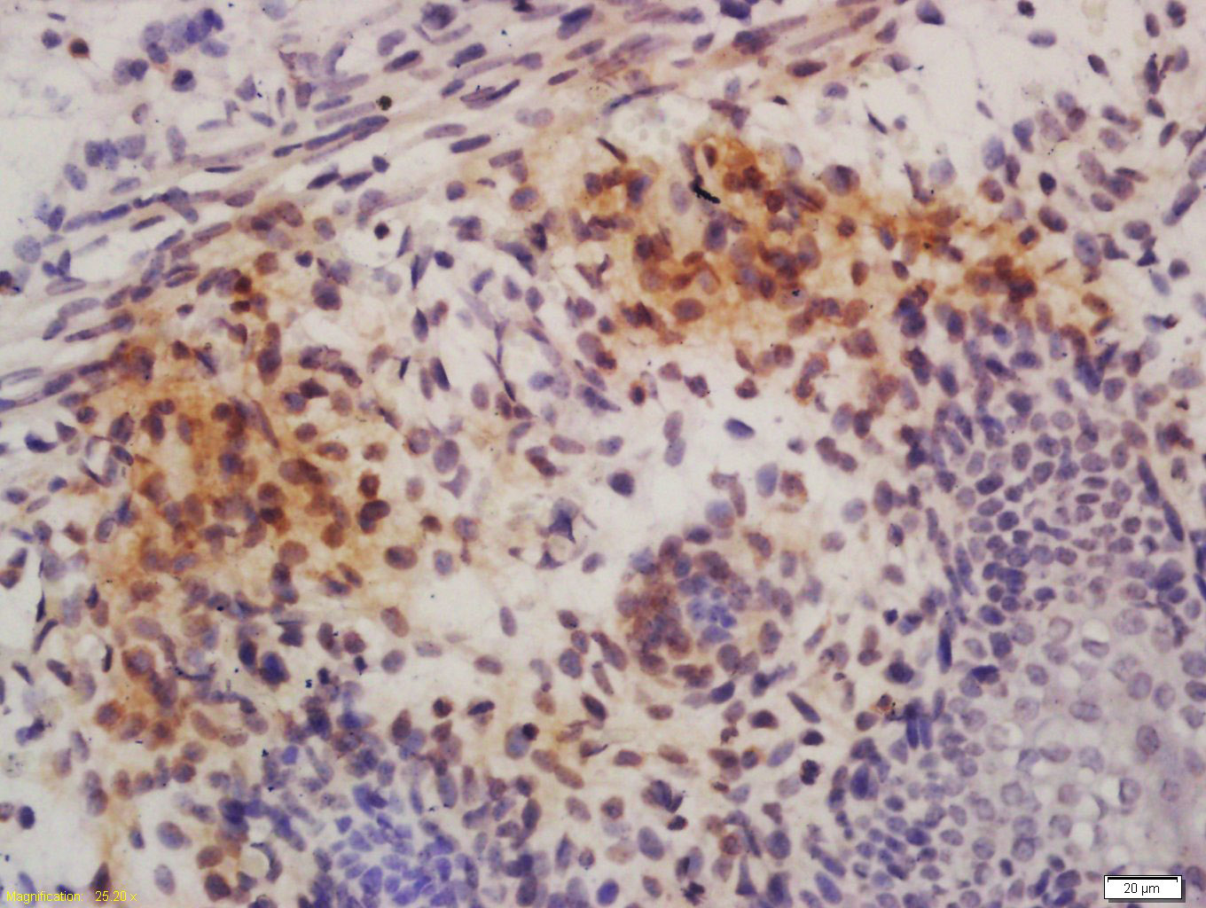 phospho-c-ABL (Tyr245) Rabbit 