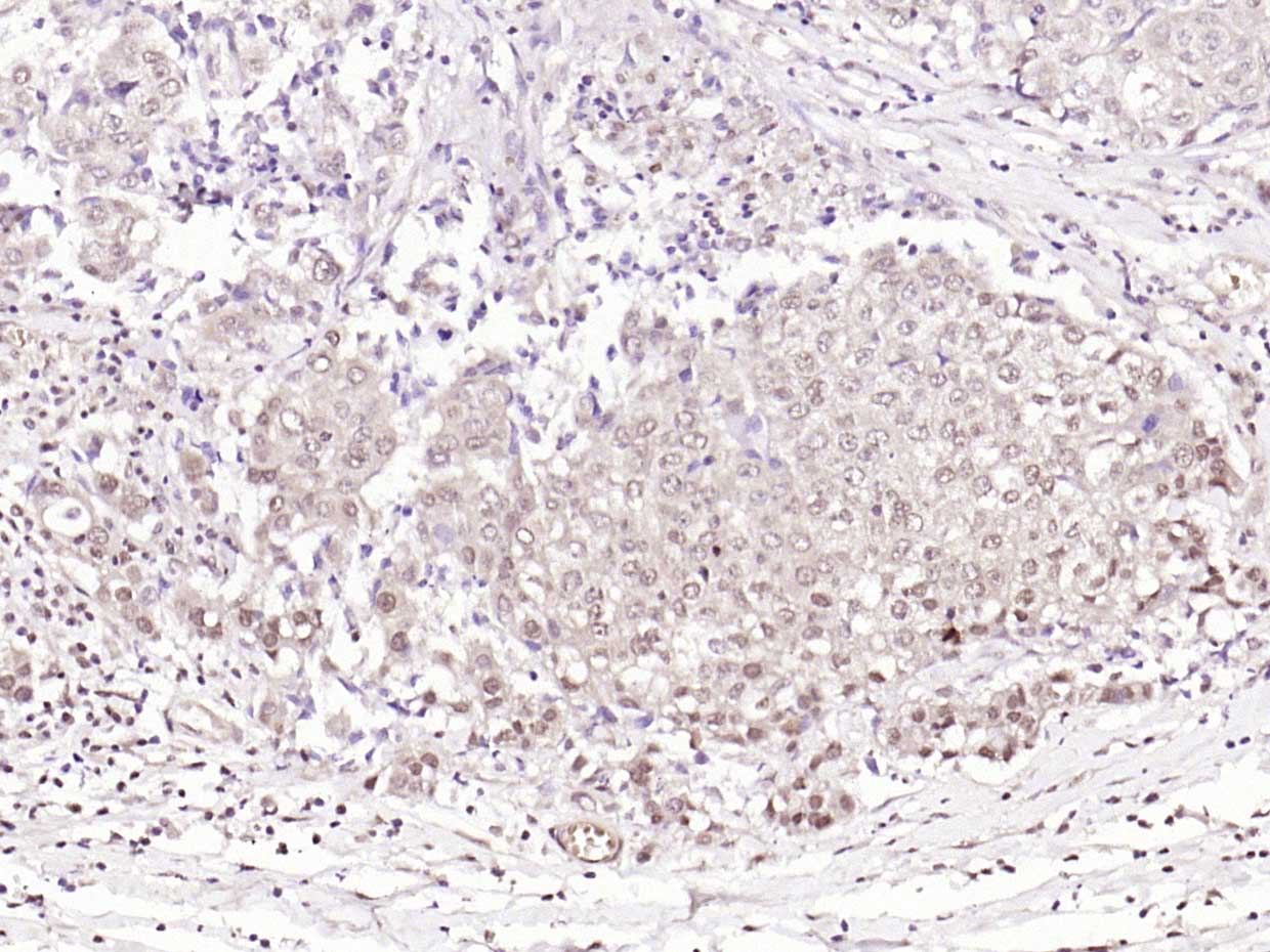 phospho-BRAF (Thr401) Rabbit p