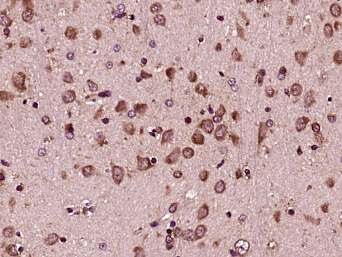 GRP94 Rabbit pAb(bs-0194R)-50u