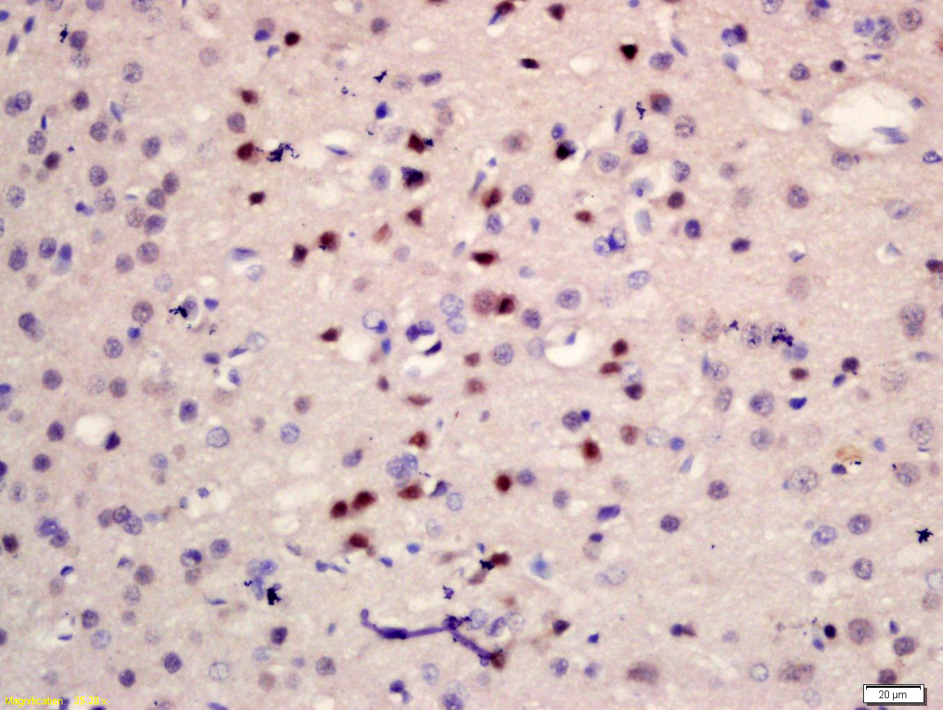 Telomerase Binding Protein, P2