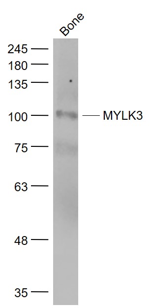 MYLK3 Rabbit pAb(bs-9865R)-50u