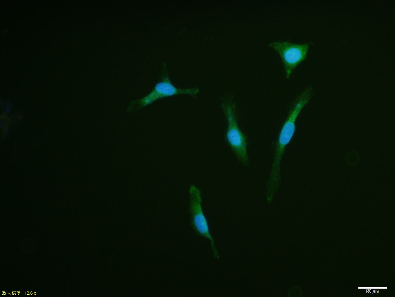 PAX8 Rabbit pAb(bs-1201R)-50ul