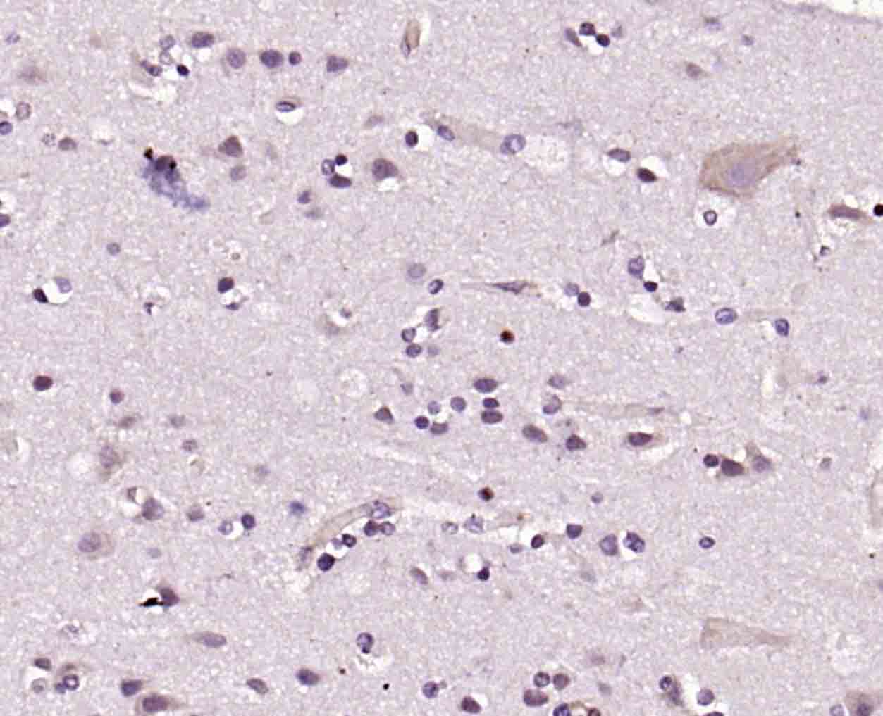 CLK2 Rabbit pAb(bs-7907R)-50ul