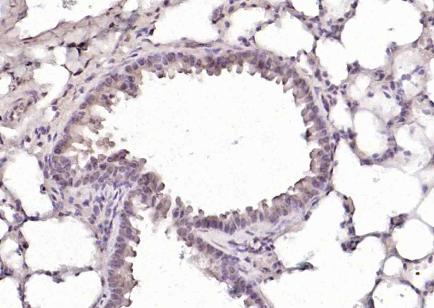 phospho-c-ABL (Tyr245) Rabbit 