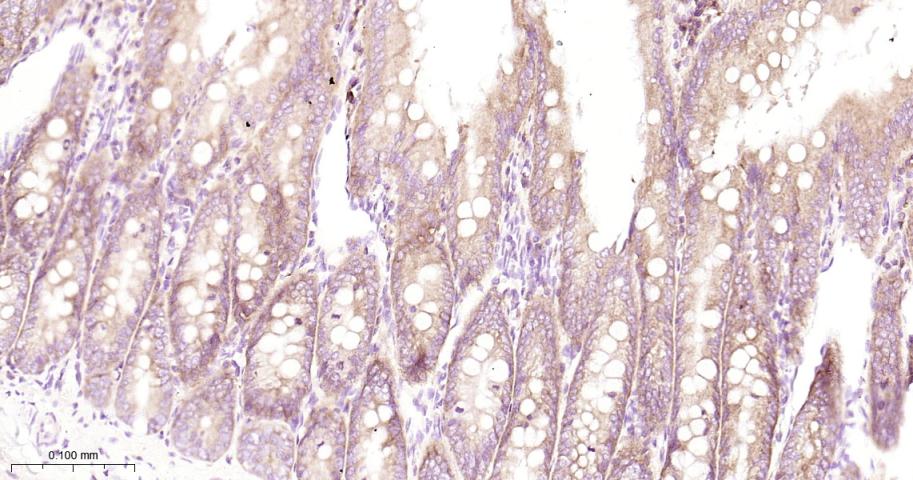 AGR2 Recombinant Rabbit mAb(bs
