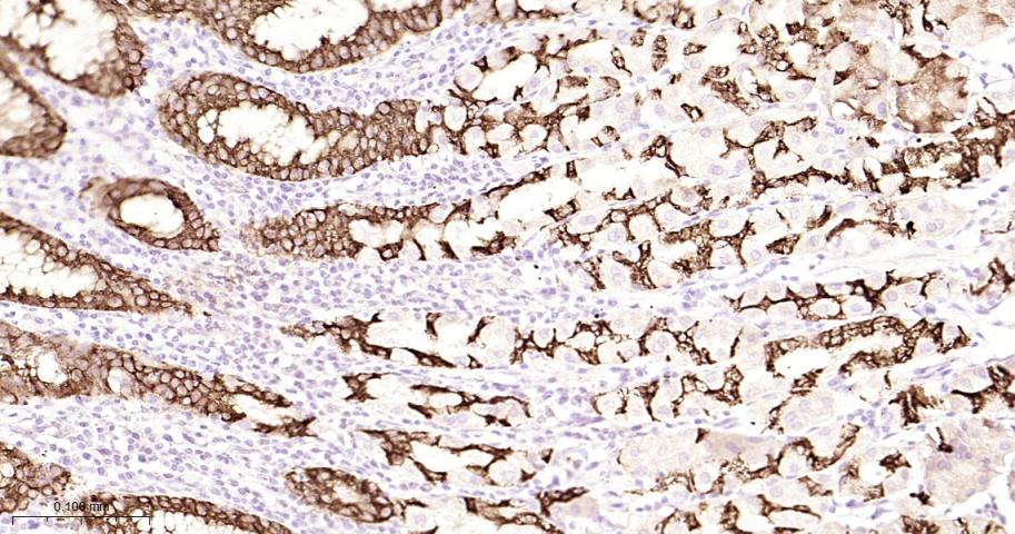 AGR2 Recombinant Rabbit mAb(bs