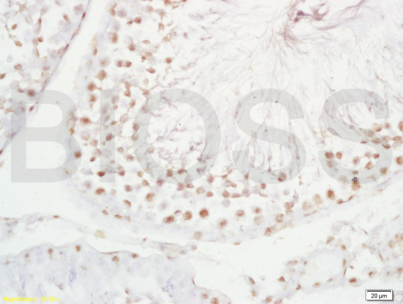 PLCZ1 Rabbit pAb(bs-5378R)-50u