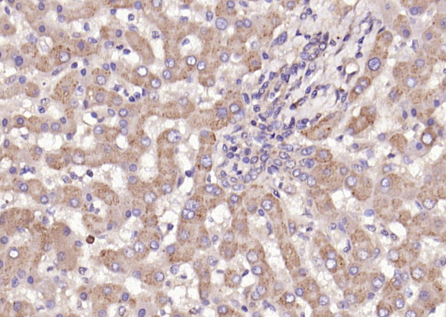 Ceramide glucosyltransferase R