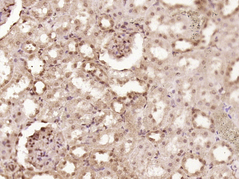 CDKN2B/p15 INK4b Rabbit pAb(bs