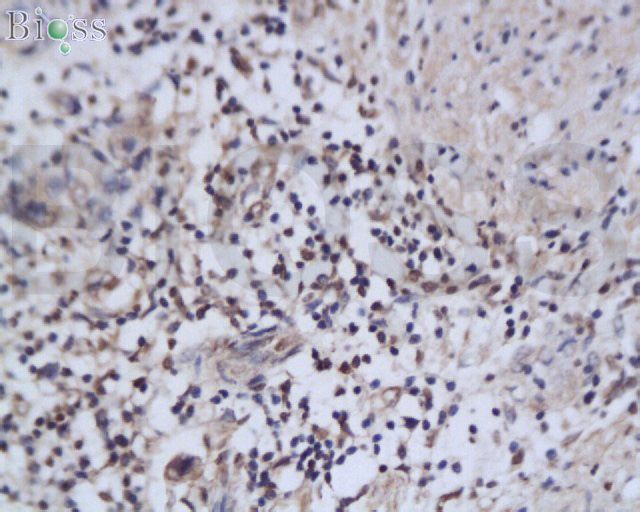 NAIF1 Rabbit pAb(bs-0452R)-50u